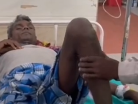 मछली पकड़ना पड़ा महंगा, आसमानी बिजली ने दो सगे भाइयों को झुलसाया