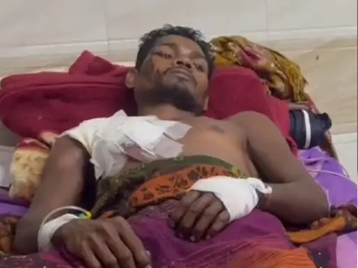 जंगली सुअर के हमले में आदिवासी युवक घायल, कोरबा मेडिकल कॉलेज में इलाज जारी