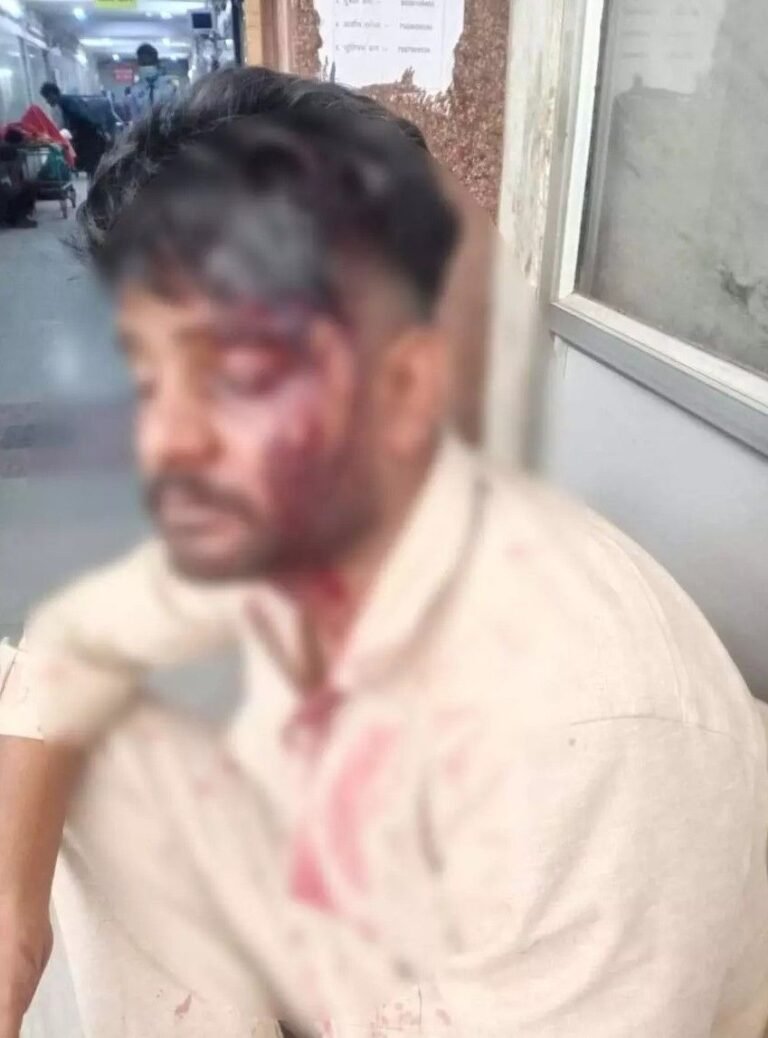उर्स के दौरान युवक पर बेसबॉल स्टिक से हमला, धारा 307 के तहत केस दर्ज