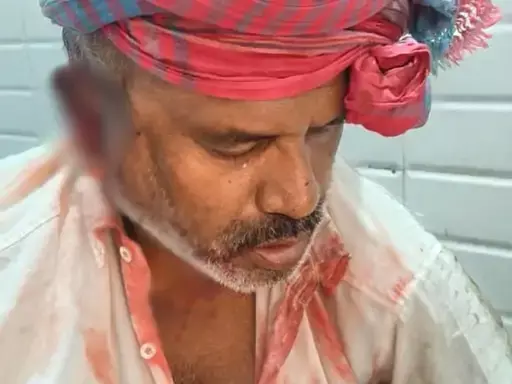 Robbery case: कबाड़ी पर हमला, 6 हजार रुपये और मोबाइल लूटे गए