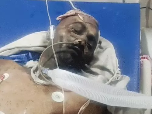 SMS hospital fire: SMS हॉस्पिटल में लगी आग से देशभर में मचा हड़कंप