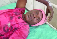 कोरबा में बड़ा हादसा टला: 132 केवी हाईटेंशन लाइन की चपेट में आए दो मजदूर, आग लगने से मचा हड़कंप