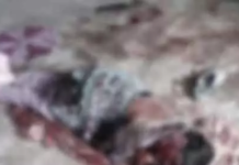 KORBA NEWS : घरेलू विवाद में पति का खौफनाक हमला, पत्नी समेत मां-बहन गंभीर