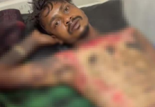 प्यार के नाम पर जलाने की कोशिश! पेट्रोल डालकर युवक को जिंदा जलाने का प्रयास, तालाब में कूदकर बचाई जान