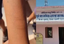 CG NEWS : स्कूल में 35 छात्रों ने काटी कलाई, जांच शुरू