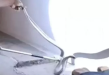 कोरबा में सड़क पर दिखा 5 फीट लंबा जहरीला नाग, रेस्क्यू टीम ने सुरक्षित पकड़ा