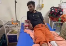 कोरबा में युवक ने पुलिस पर लगाया मारपीट का आरोप, जांघ की हड्डी टूटने का दावा