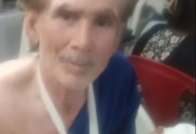 ब्रेकिंग न्यूज़: बालको वेदांता संयंत्र में हादसा, श्रमिक की तीन उंगलियां कटीं