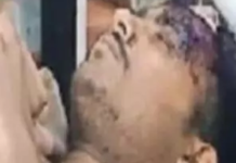 CG BREAKING NEWS: पुलिस टीम पर हमला, टीआई समेत कई घायल; 10 आरोपी गिरफ्तार