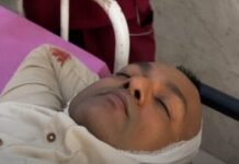 कोरबा फरार आरोपी कोर्ट परिसर में दूसरी मंजिल से गिरा, हालत गंभीर