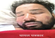 कोरबा में बोलेरो सवारों की दबंगई: युवक को कुचला, पीछा करने वाले पत्रकार को बनाया निशाना