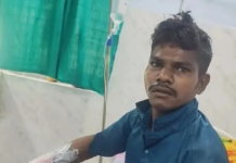 Korba Crime News: दोस्त की पत्नी पर टिप्पणी से भड़का युवक, दोस्त पर पेट्रोल डालकर लगाई आग; खुद भी झुलसा