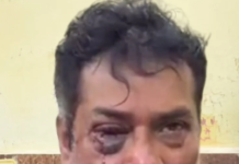 कांग्रेस नेता पर जानलेवा हमला, घर में घुसे 15-20 हथियारबंद बदमाश; भाजपा नेता पर लगाए गंभीर आरोप